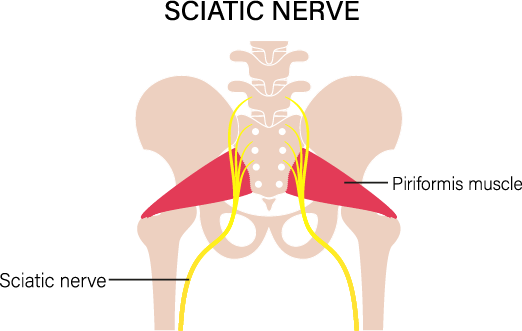 Sciatic Nerve-Best Neurologist